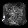 <a href="papers_abstracts/abstracts/110.html">DCE-MRI-oriented Volume Rendering for Monitoring of Crohn's Disease</a>