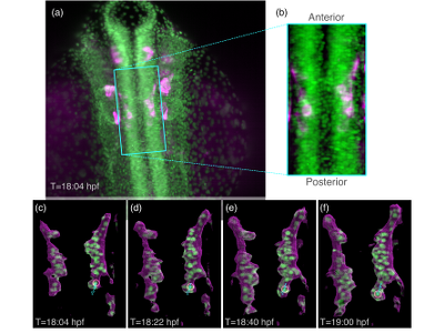Visualizing the Trajectories and Contexts of Facial Branchiomotor Neuron Pioneers