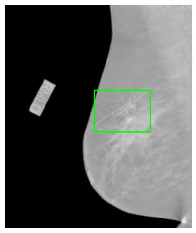 cancer annotations